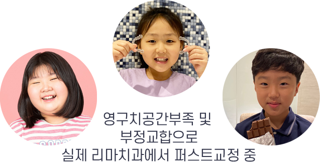 영구치공간부족 및 부정교합으로 실제 리마치과에서 퍼스트교정 중
